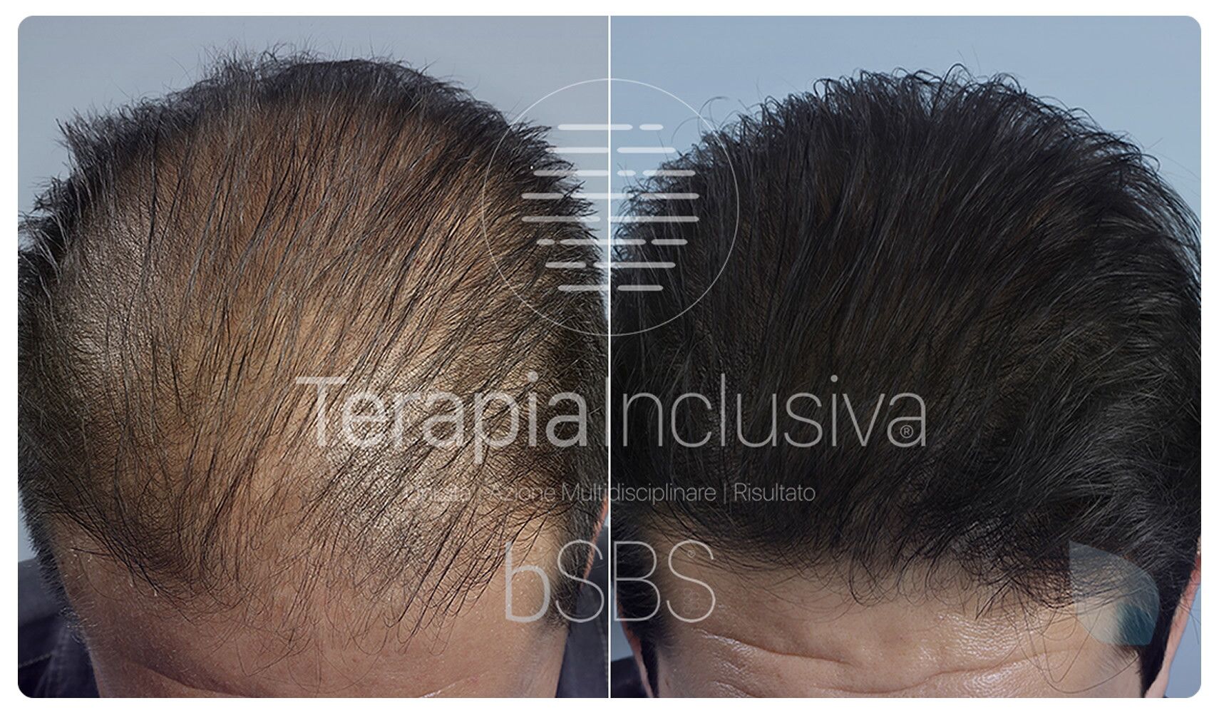 © Hairclinic