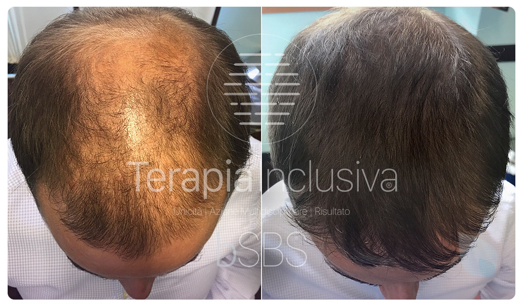 © Hairclinic