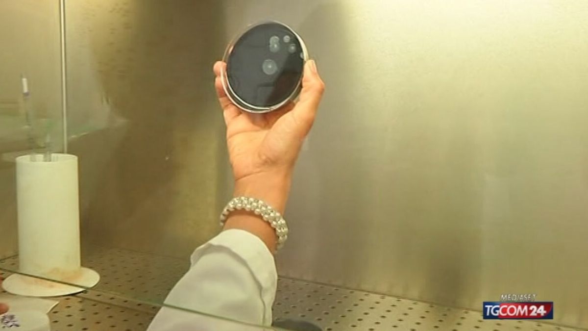 18.00 LEGIONELLA, ALTRI DUE CASI SRV