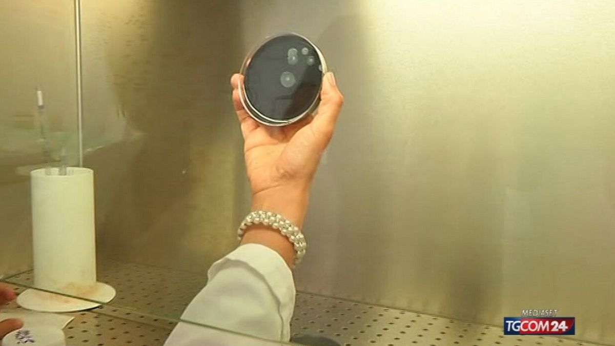 18.00 LEGIONELLA, ALTRI DUE CASI SRV