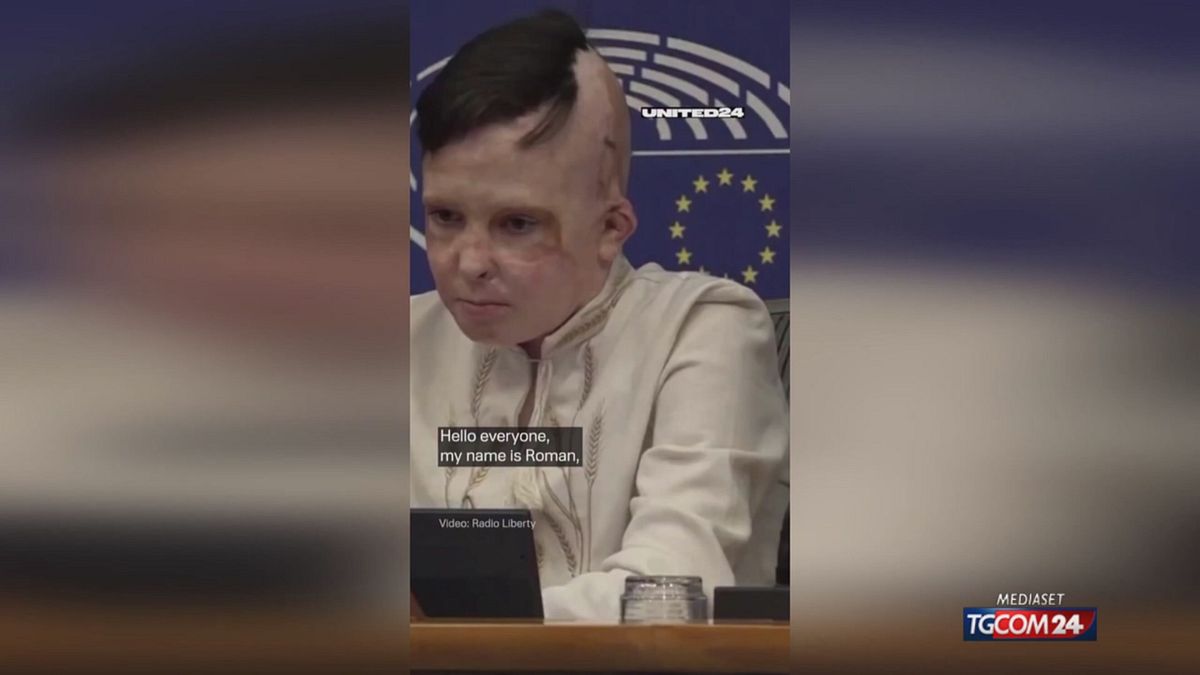 RAGAZZO USTIONATO PARLAMENTO EUROPEO X SITO SRV