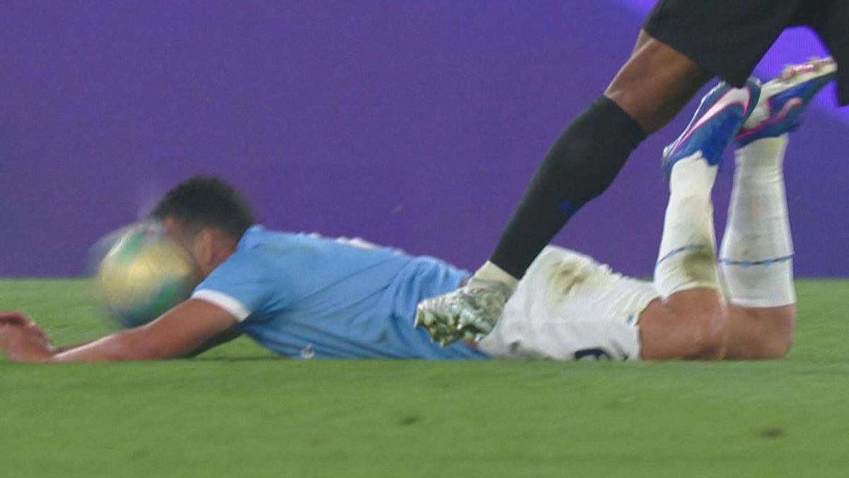 Luis Henrique "spacca" la faccia a Pedro