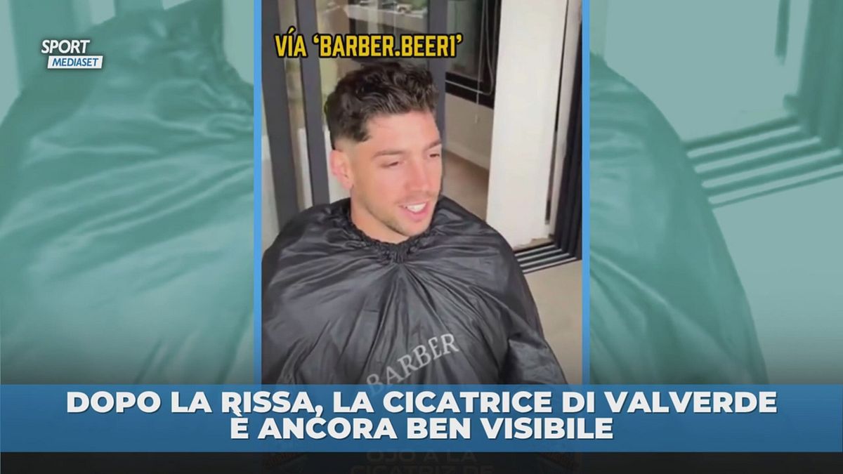 Dopo la rissa, la cicatrice di Valverde è ancora ben visibile