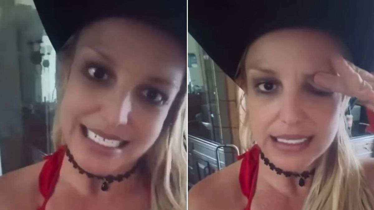  Le conseguenze del botox sul viso di Britney Spears