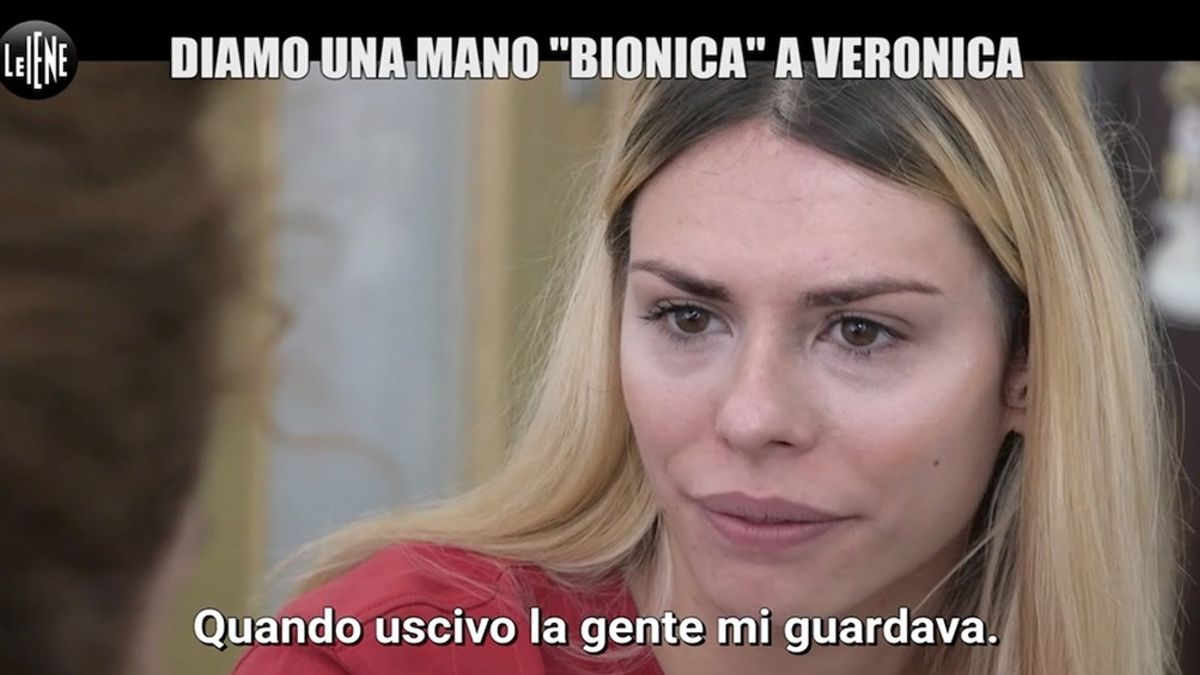 Napoli, a Le Iene il sogno di una 22enne nata senza un braccio: "Non ho mai avuto una protesi perché non posso permettermela"