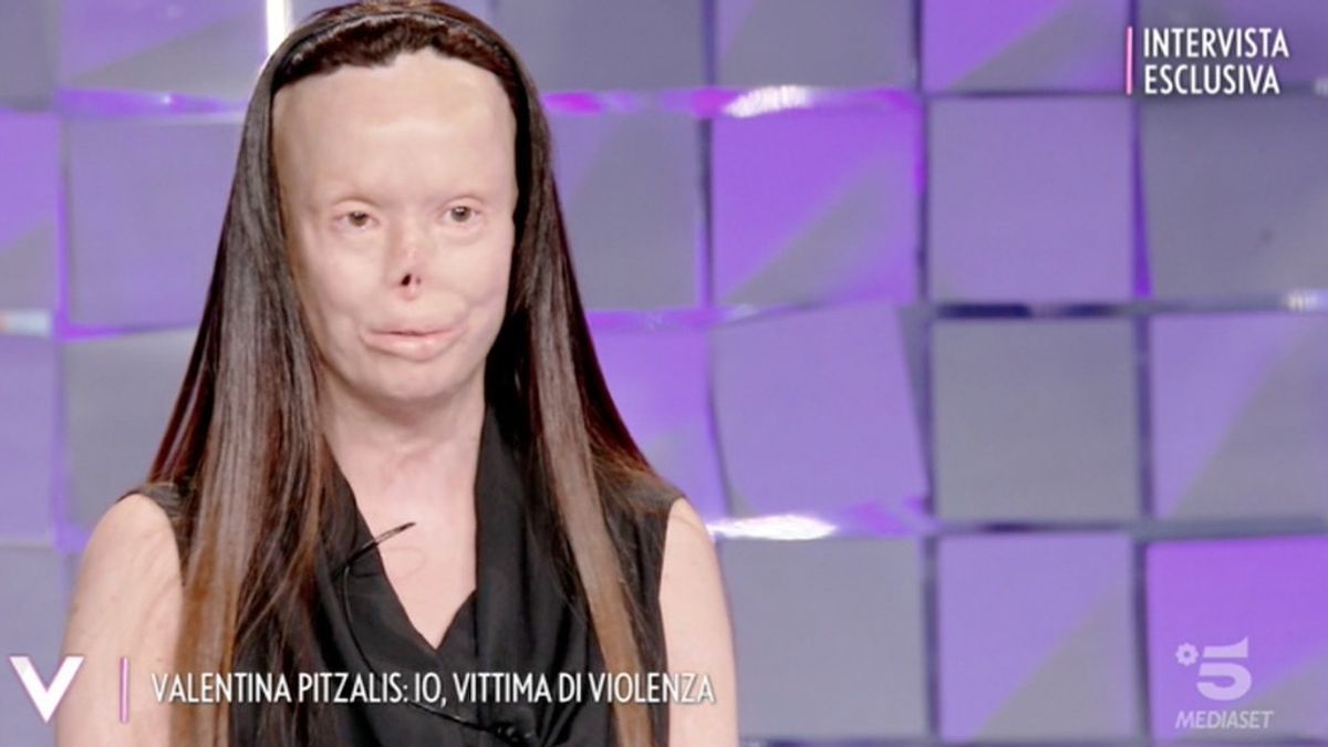 Valentina Pitzalis a "Verissimo": "Mio marito mi ha distrutto la vita ma non mi ha tolto il sorriso"