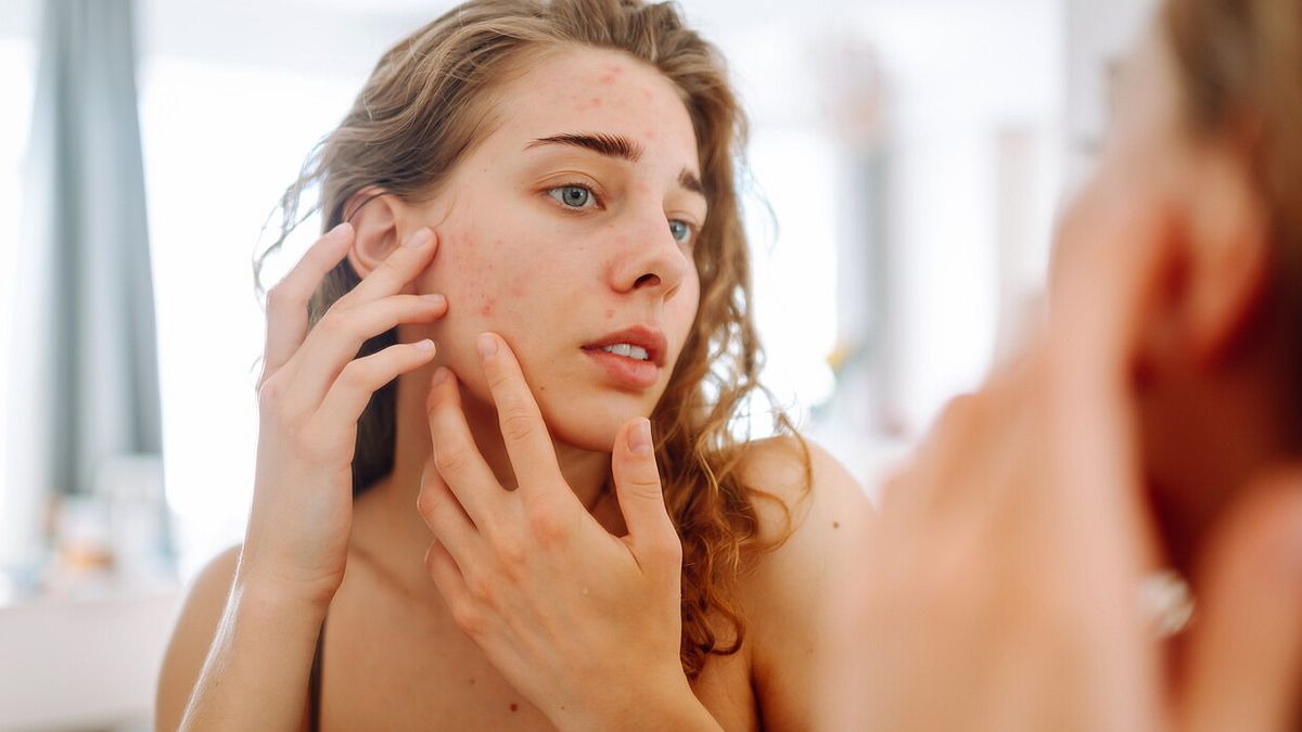 Kusurlu cilt için 10 zorbadan 4'ü