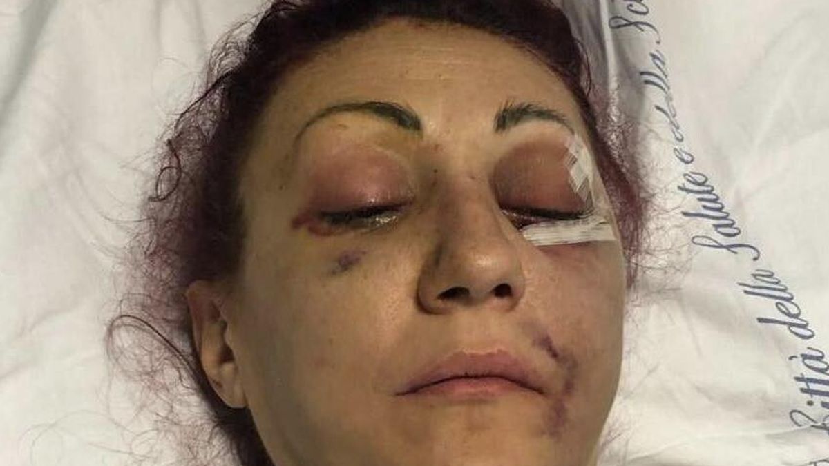 Torino, massacrò la ex ma viene assolto: "Lei distrusse il matrimonio, va compreso"
