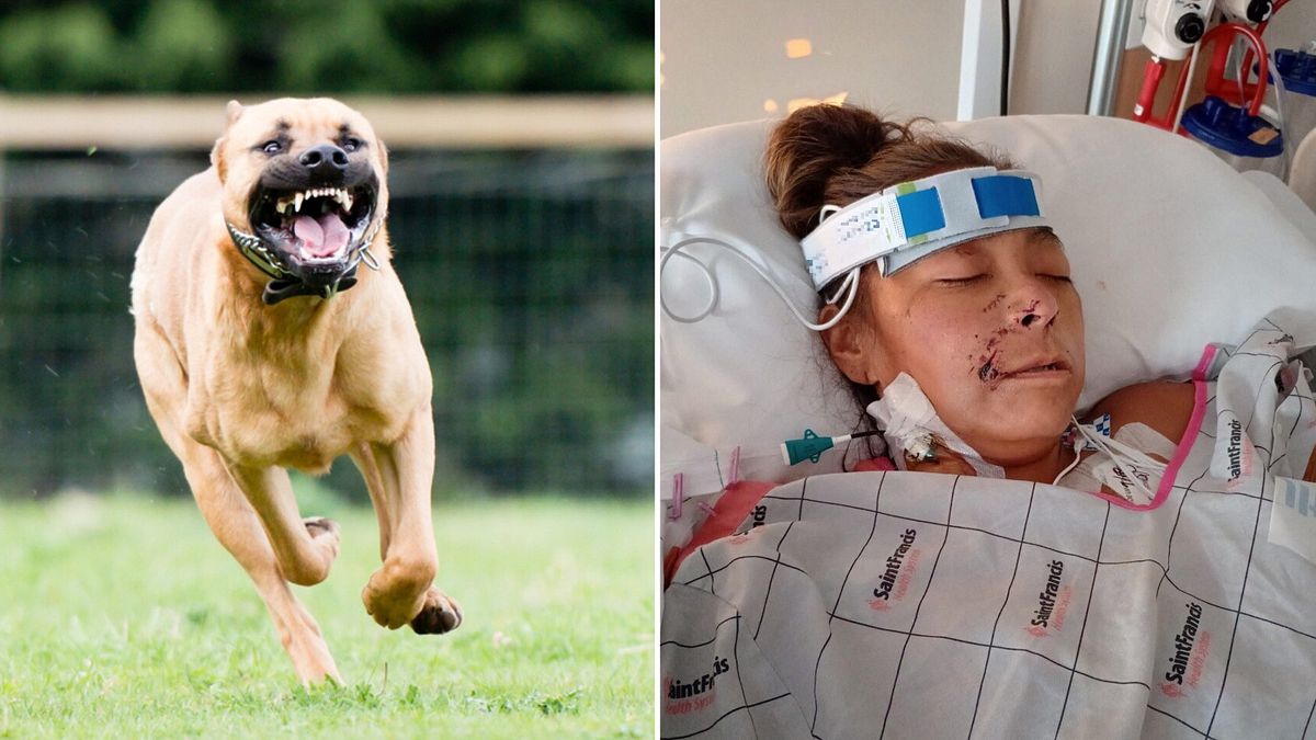 usa donna aggredita da due pitbull durante un giro in bici amputate braccia e gambe