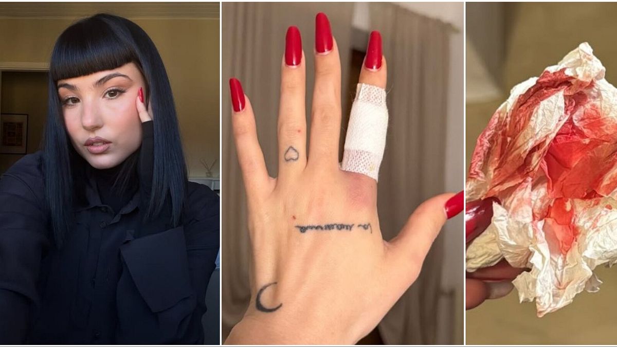 Giorgia Soleri geçirdiği ev kazasının ardından hastaneye kaldırıldı