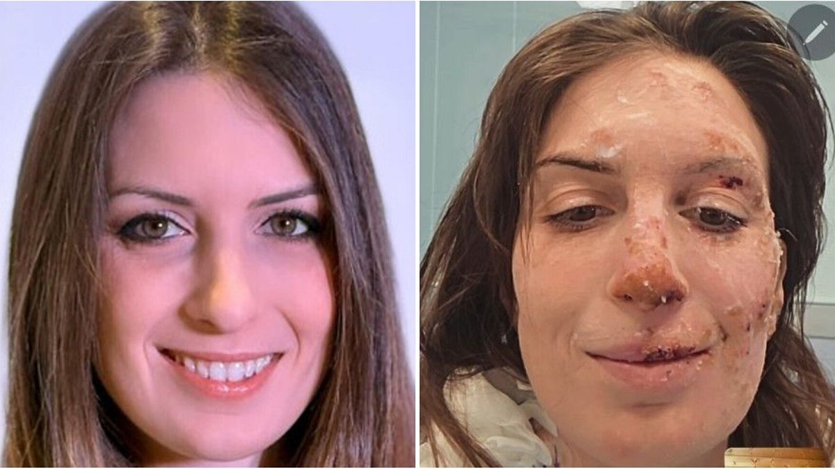 Crans Montana, Eleonora Palmieri dimessa dall