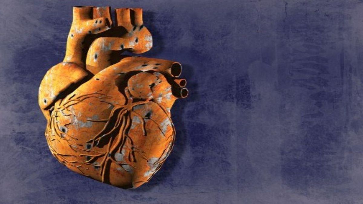 Cardiac Drug Use Falls Short for Global Patients