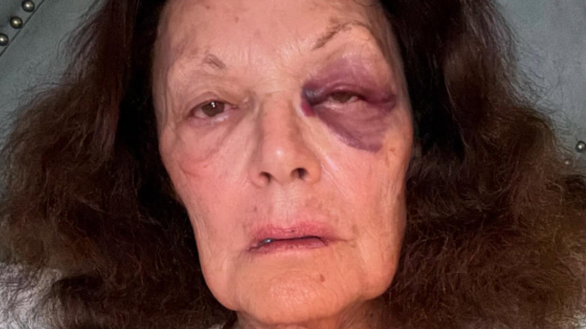 Diane von Furstenberg sosyal medyada şok çekimleri yayınladı