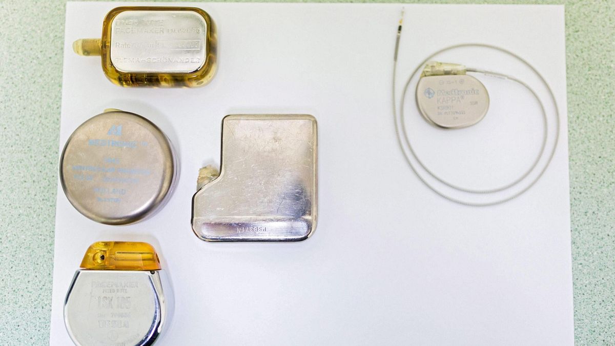 Cos'è e come funziona il pacemaker: l'intervento, il ricovero e la ...
