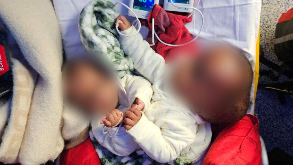 Genova, al Gaslini l'intervento per separare due gemelle siamesi