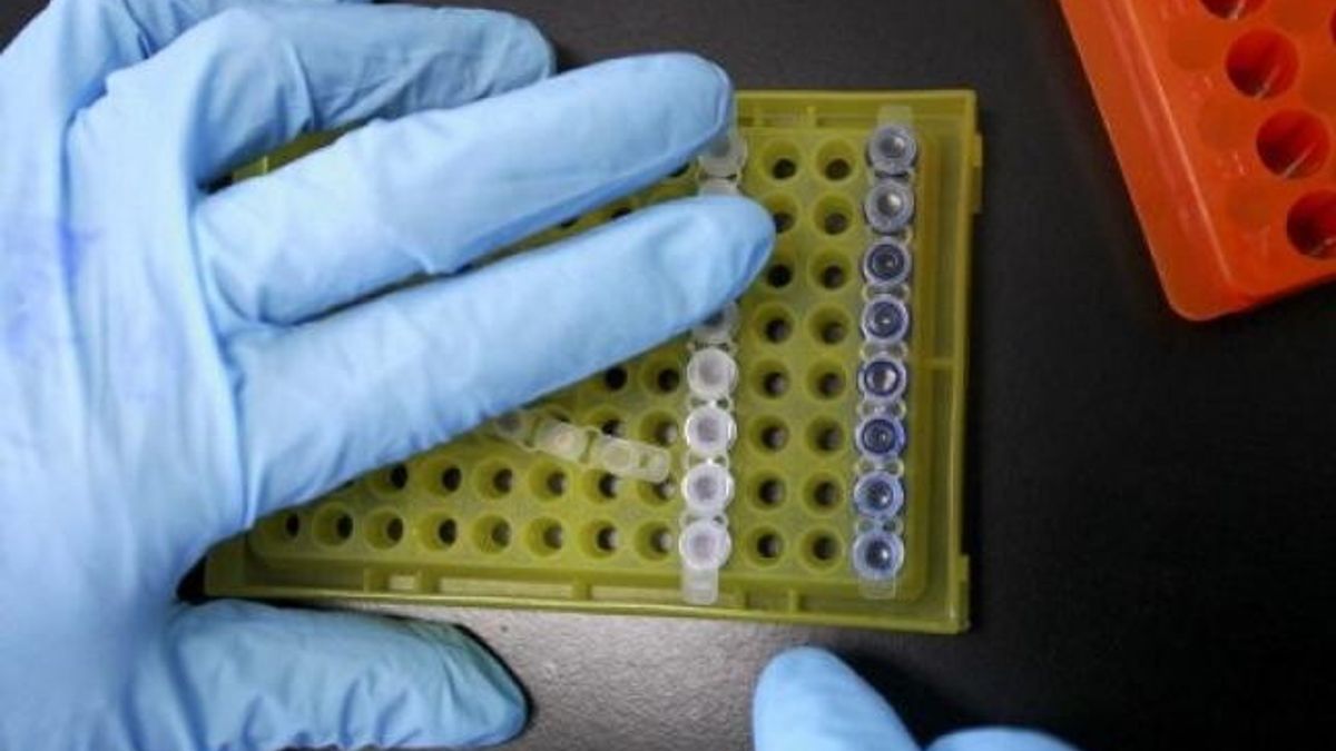 Miyeloid lösemi, ne ve nasıl savaştığın