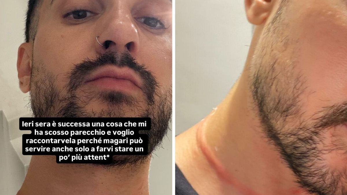 Mr Daniel aggredito e rapinato a Milano © Instagram