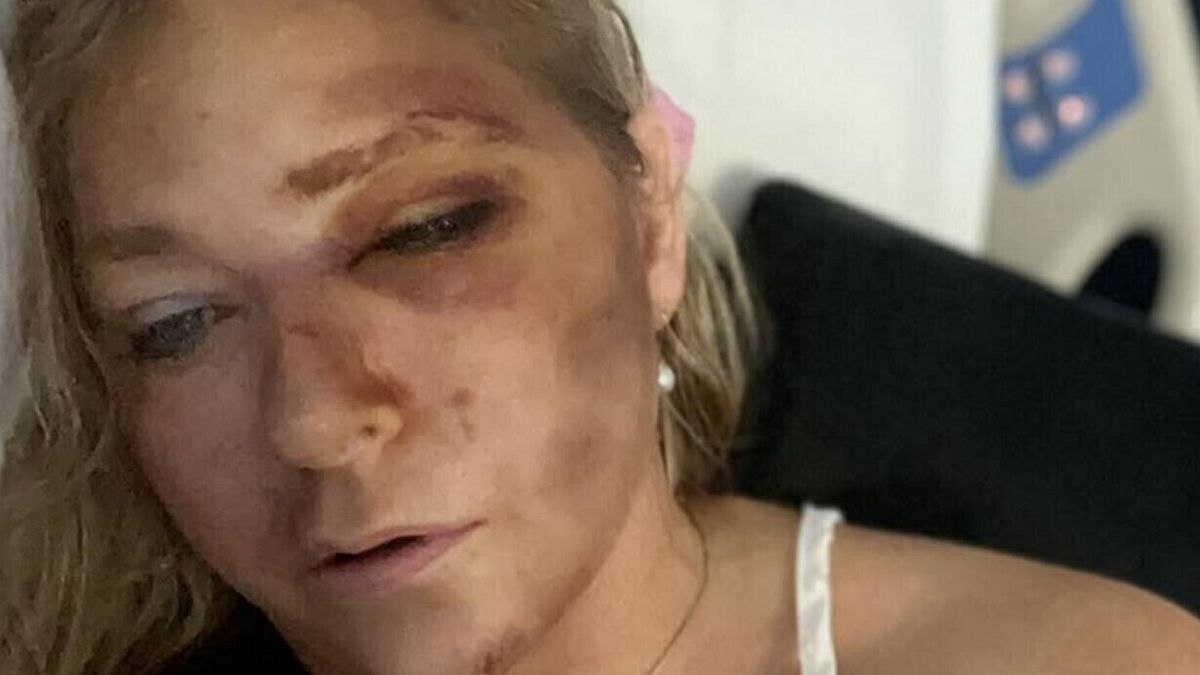  Virginia Giuffre in ospedale. L'accusatrice di Epstein e del principe Andrea dice di avere solo quattro giorni di vita © Instagram