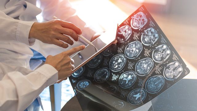 © Istockphoto