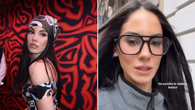 © Instagram |  Le labbra di Giulia De Lellis prima e dopo la ialuronidasi