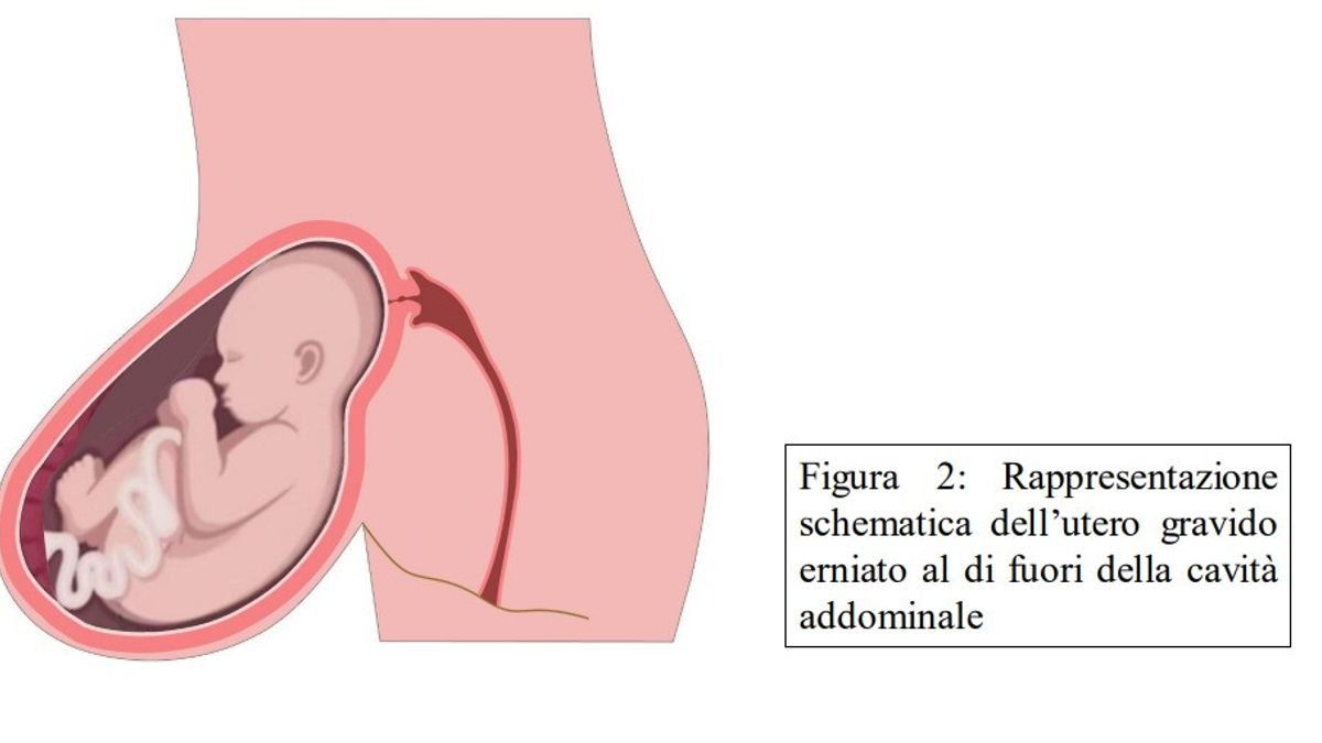 © Ufficio stampa