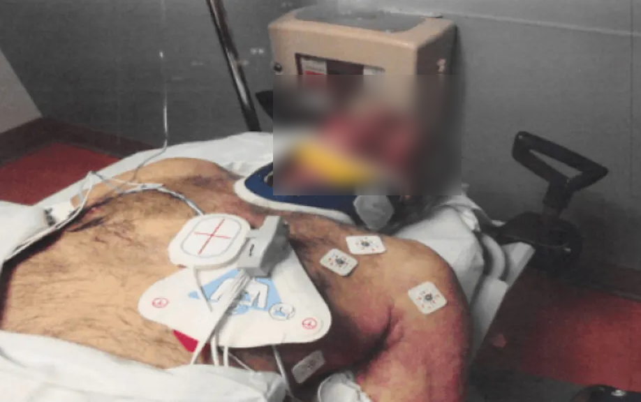 © Dal Web  | Jeffrey Epstein sul lettino del carcere durante le operazioni di rianimazione