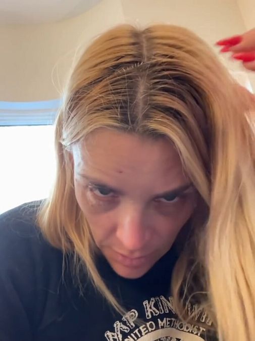 © Instagram  | Busy Philipps dopo l'operazione al cervello