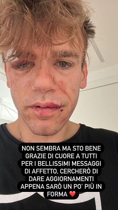 © Instagram 
