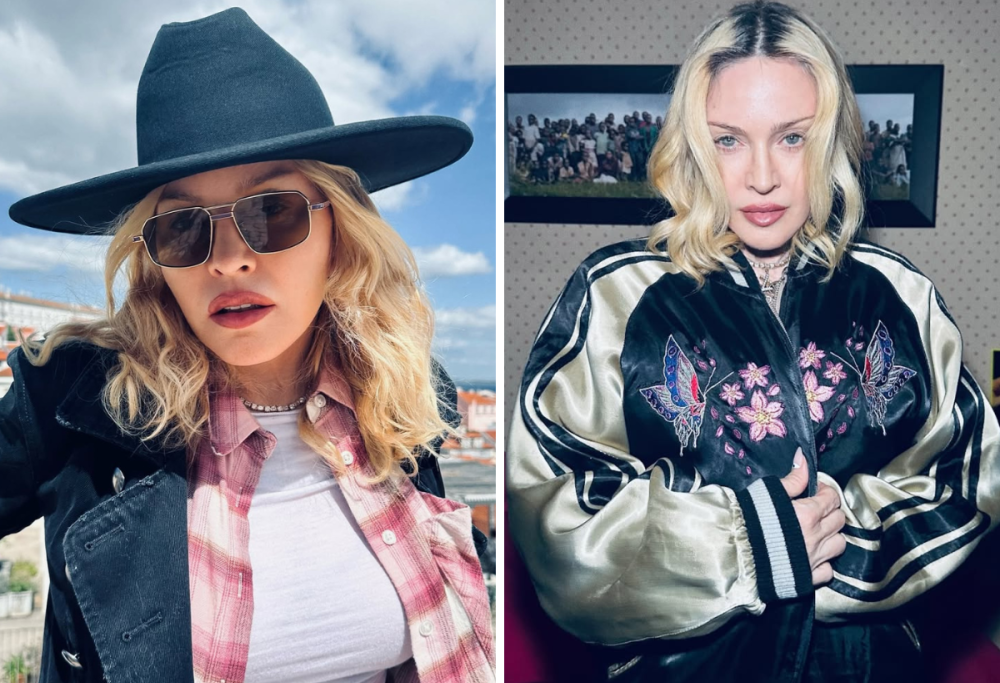 Madonna e il malore: “Stavo provando e sono finita in intensiva”