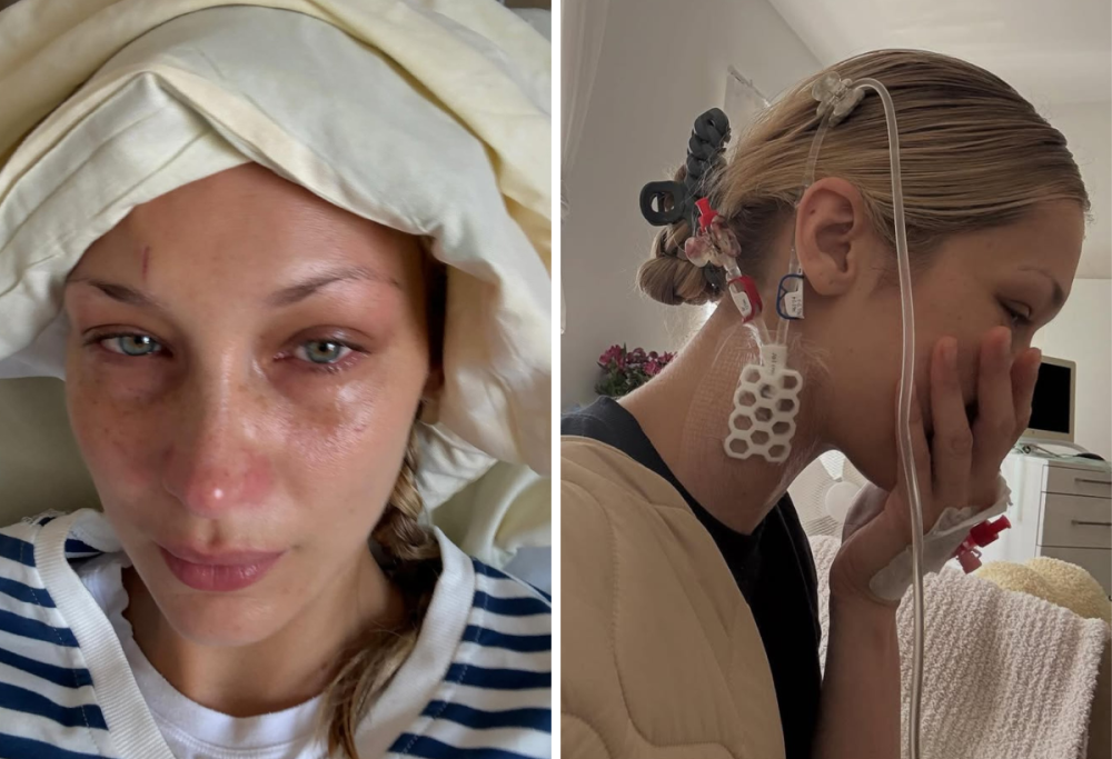 Bella Hadid ricoverata in ospedale: come sta e cos’ha la modella