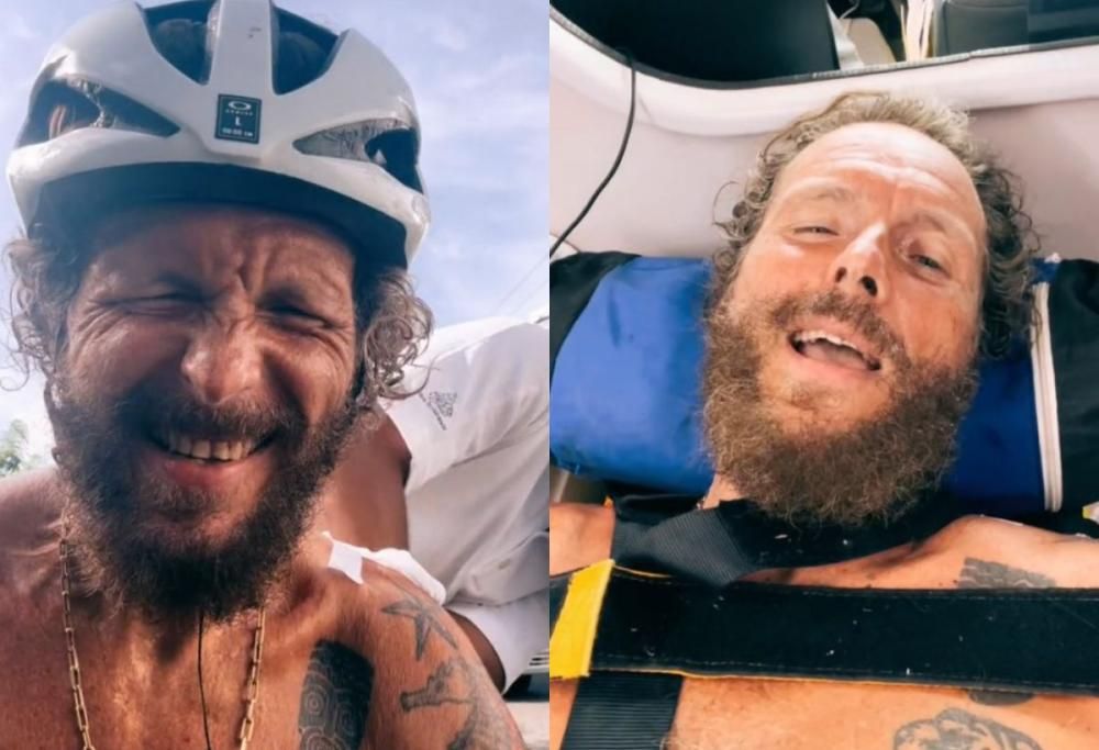 Jovanotti cade in bici: “Ho rotto clavicola e femore in tre punti”