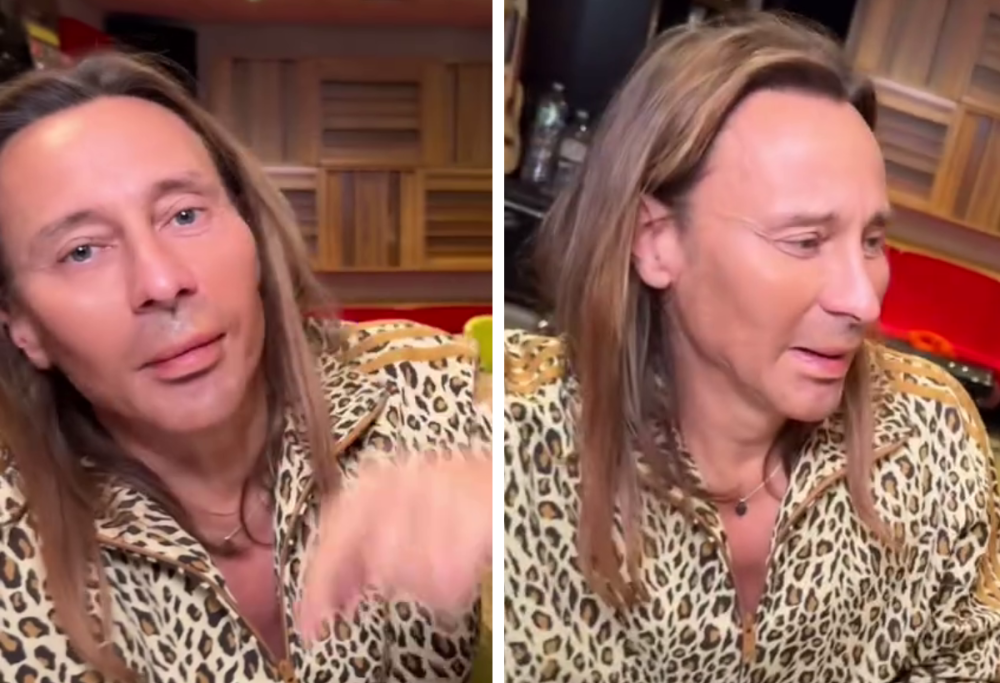 Bob Sinclair, era tutto finto? Rivelata la verità sul “lifting”