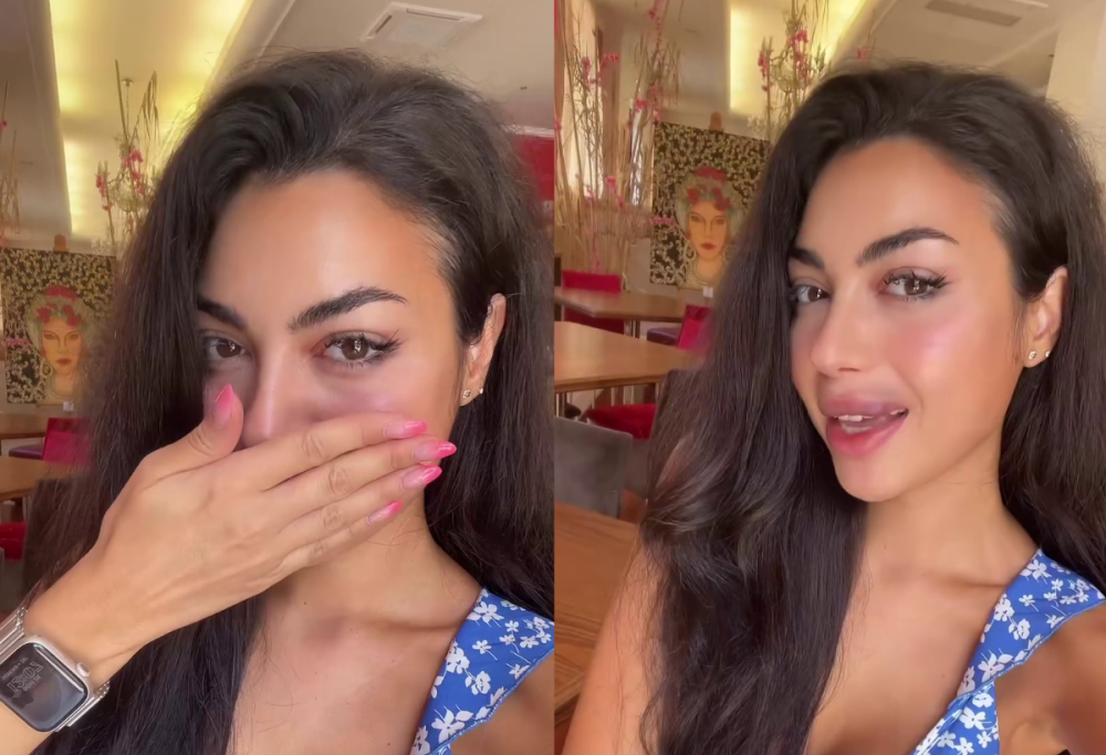 Temptation Island, dopo le critiche Jenny “sgonfia” le labbra