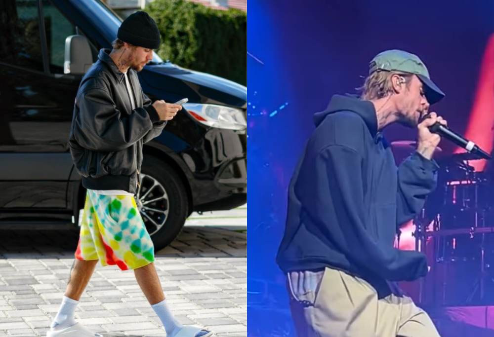 Cosa succede a Justin Bieber? I fan sono preoccupati per lui