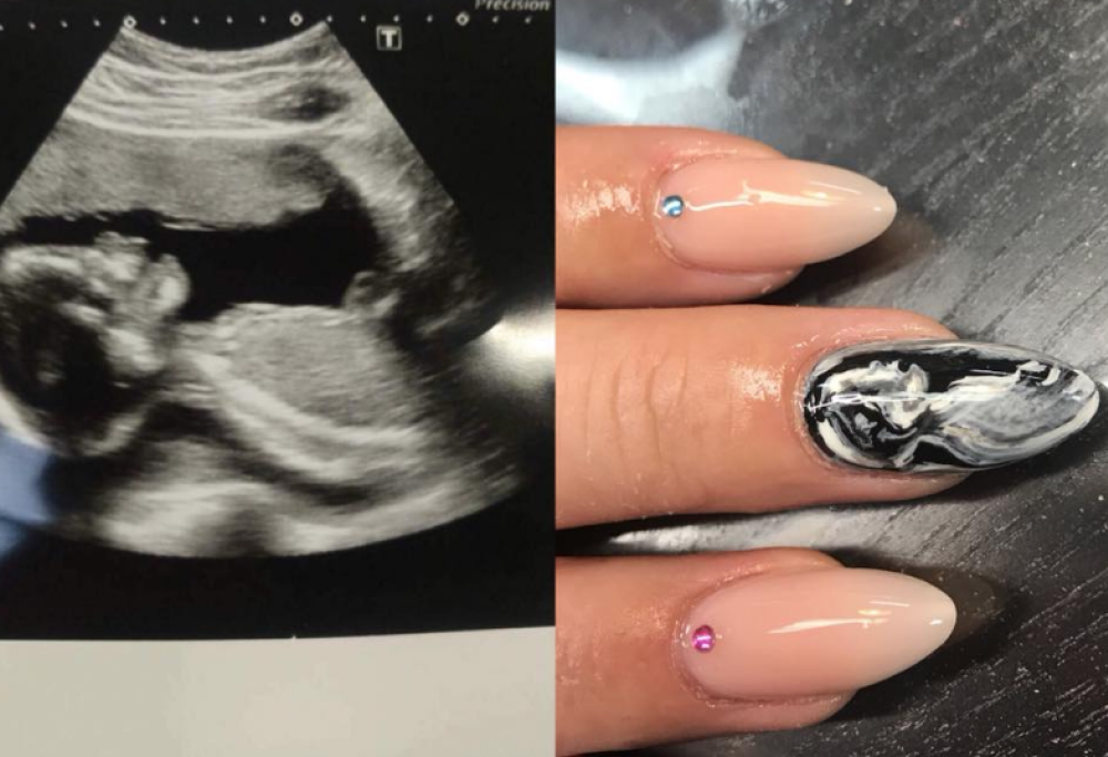 L’ecografia del bambino sulle unghie: l’ultima moda in fatto di nail art