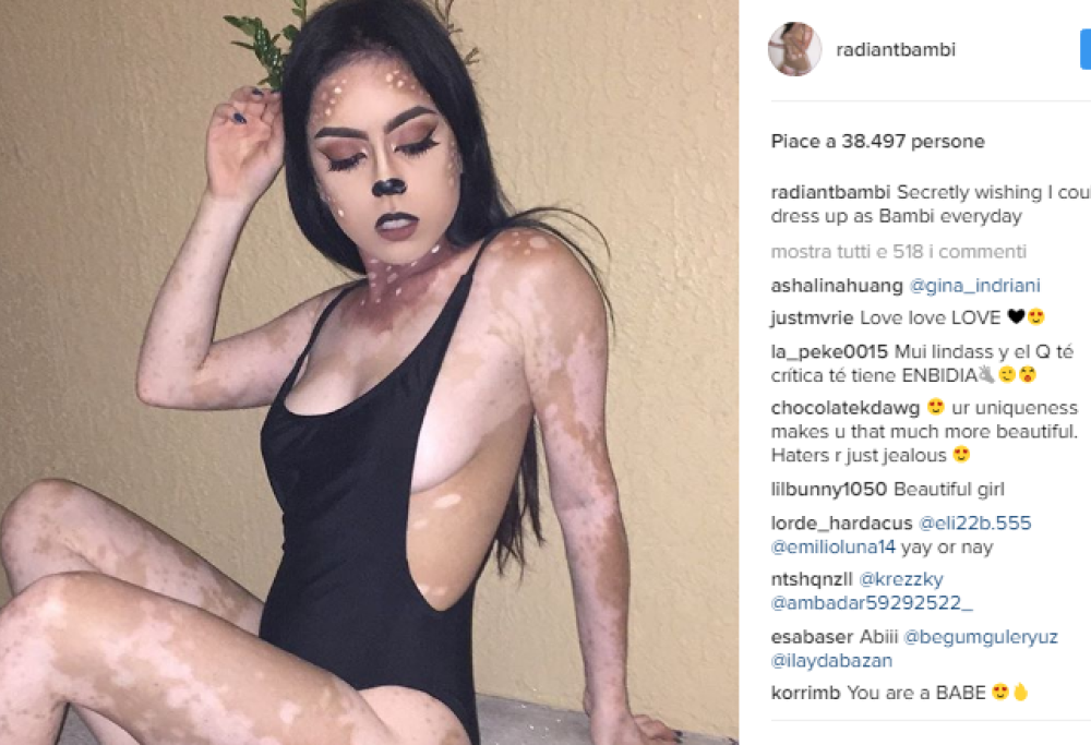 Ash Soto, la 21enne con la vitiligine che ha fatto del suo corpo un’opera d’arte