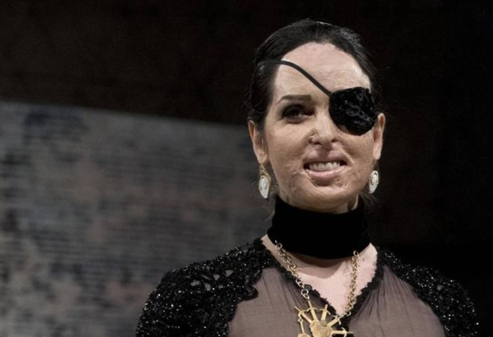 Gessica Notaro torna in passerella. La rivincita della modella sfregiata con l’acido