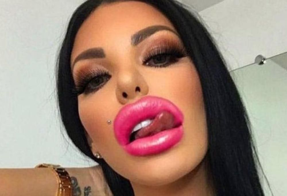 Scoppia la moda delle labbra da pornostar: le foto inquietanti