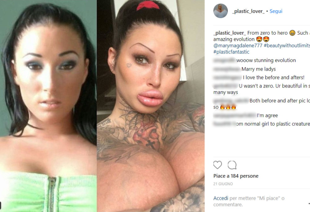 Appassionata di chirurgia estetica, decide di trasformarsi così…