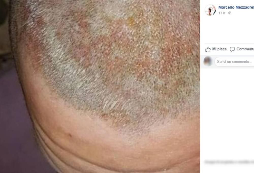 Va dal parrucchiere cinese per farsi bionda, ma le bruciano il cuoio capelluto: la denuncia sui social