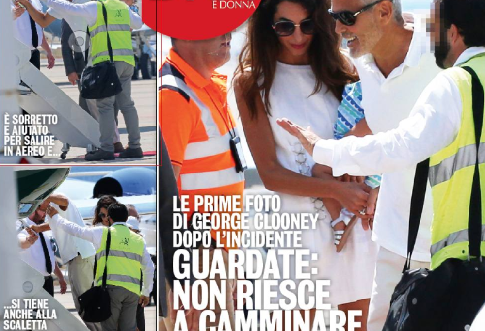 George Clooney: le prime foto dopo il brutto incidente in moto