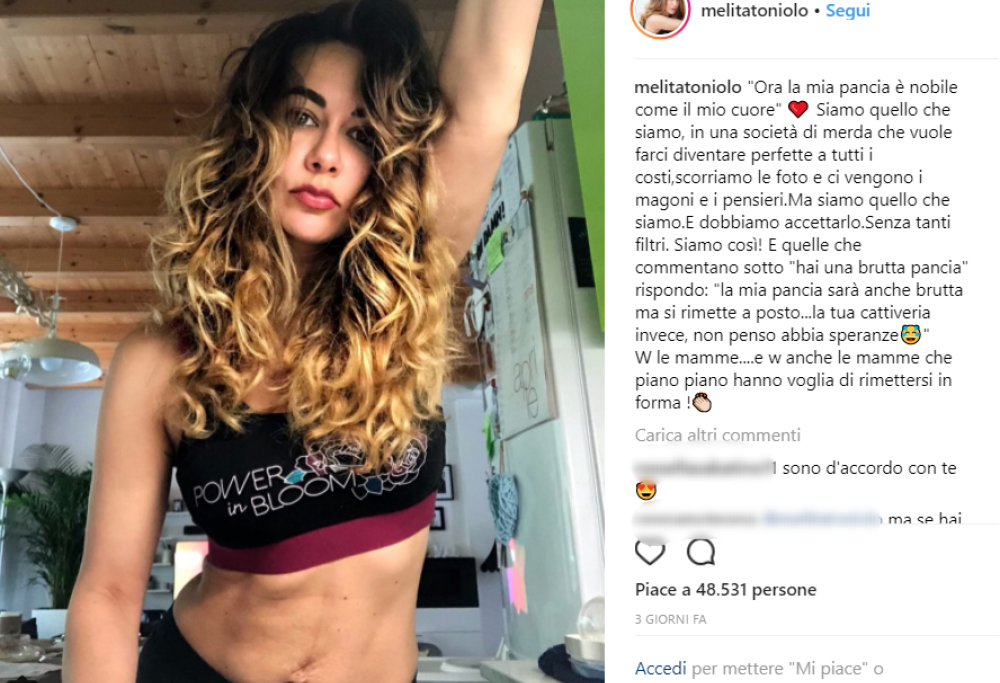 Melita Toniolo mostra la pancia dopo la gravidanza: “Siamo quello che siamo e dobbiamo accettarlo”