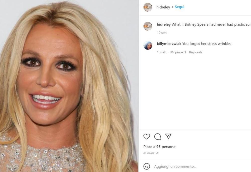 Come sarebbero le star se la chirurgia estetica non esistesse?