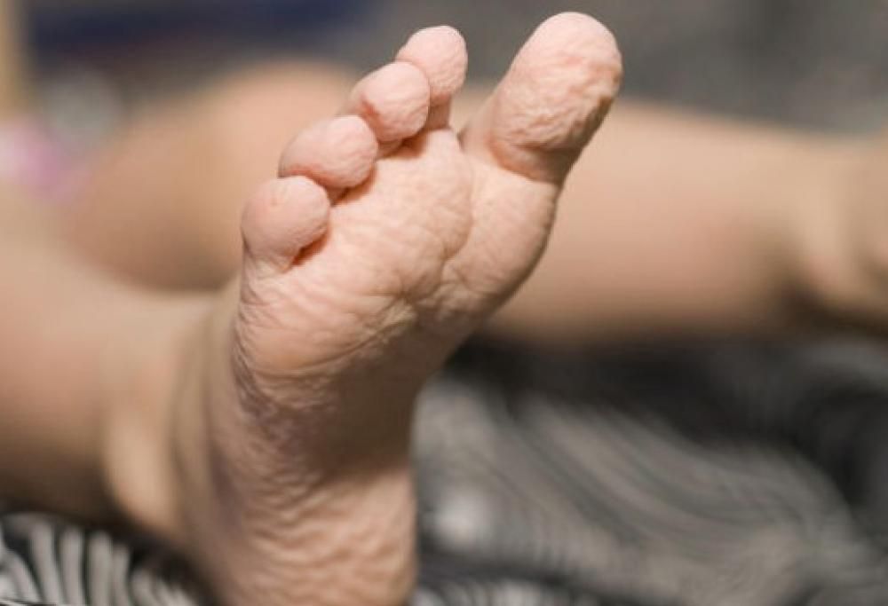 Perché i polpastrelli diventano rugosi in acqua?