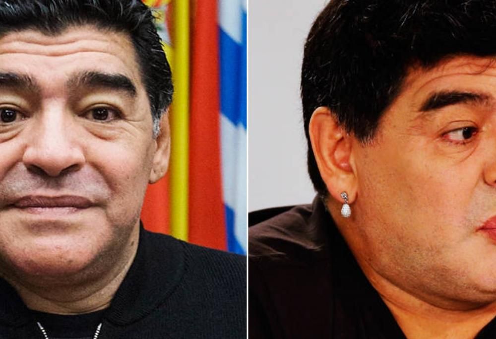 Vip e chirurgia plastica: prima e dopo il disastro!