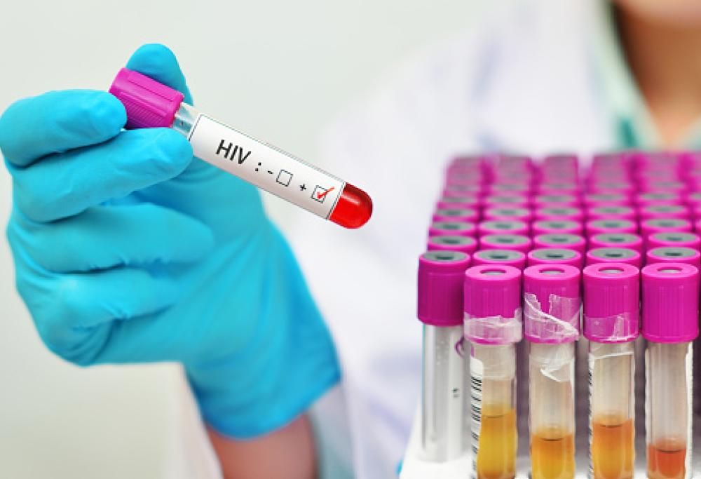 AIDS, scoperto nuovo ceppo dell’HIV