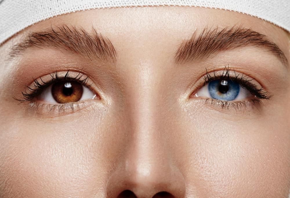 Cambiare colore degli occhi da marroni a blu: intervento laser per farlo in 20 secondi