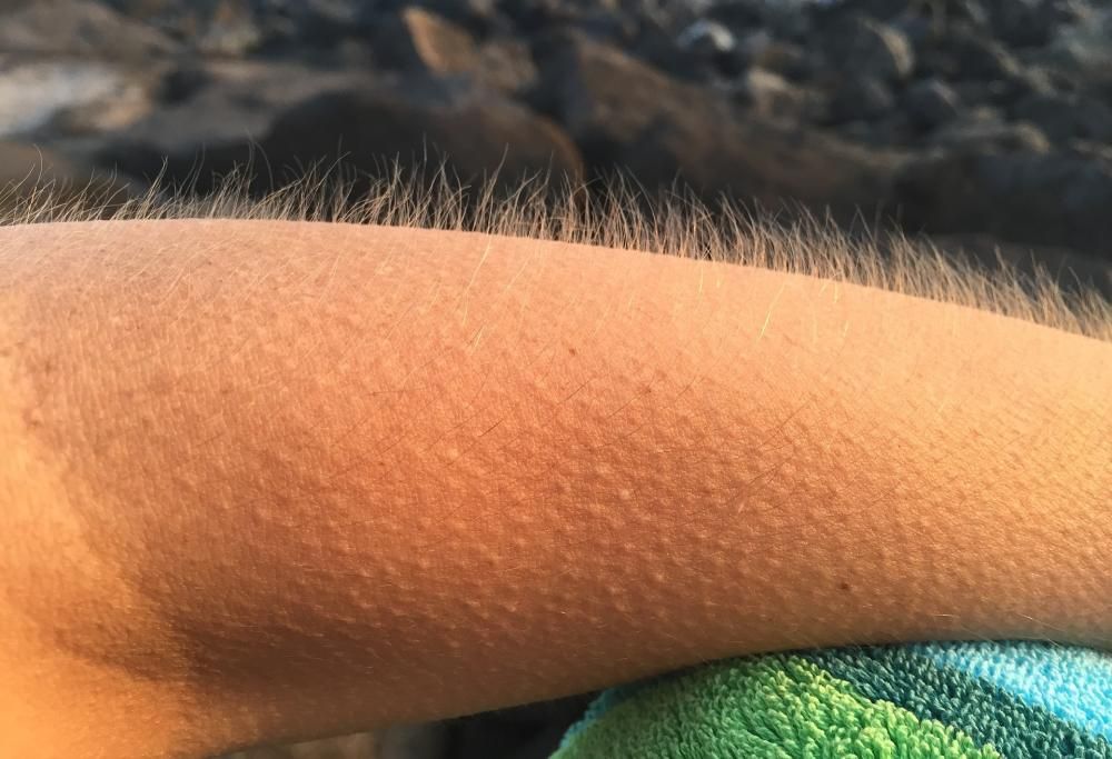 Ecco perché la musica ti fa venire la pelle d’oca