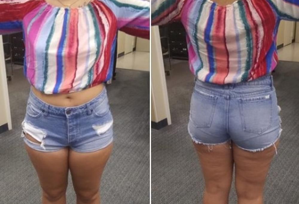 Pantaloncini troppo corti: ragazza viene buttata fuori dal centro commerciale