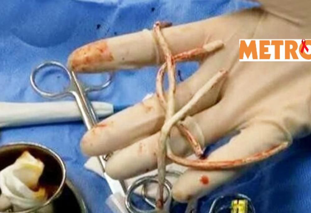 USA UN CAVO USB PER DARSI PIACERE. CORSA AL PRONTO SOCCORSO